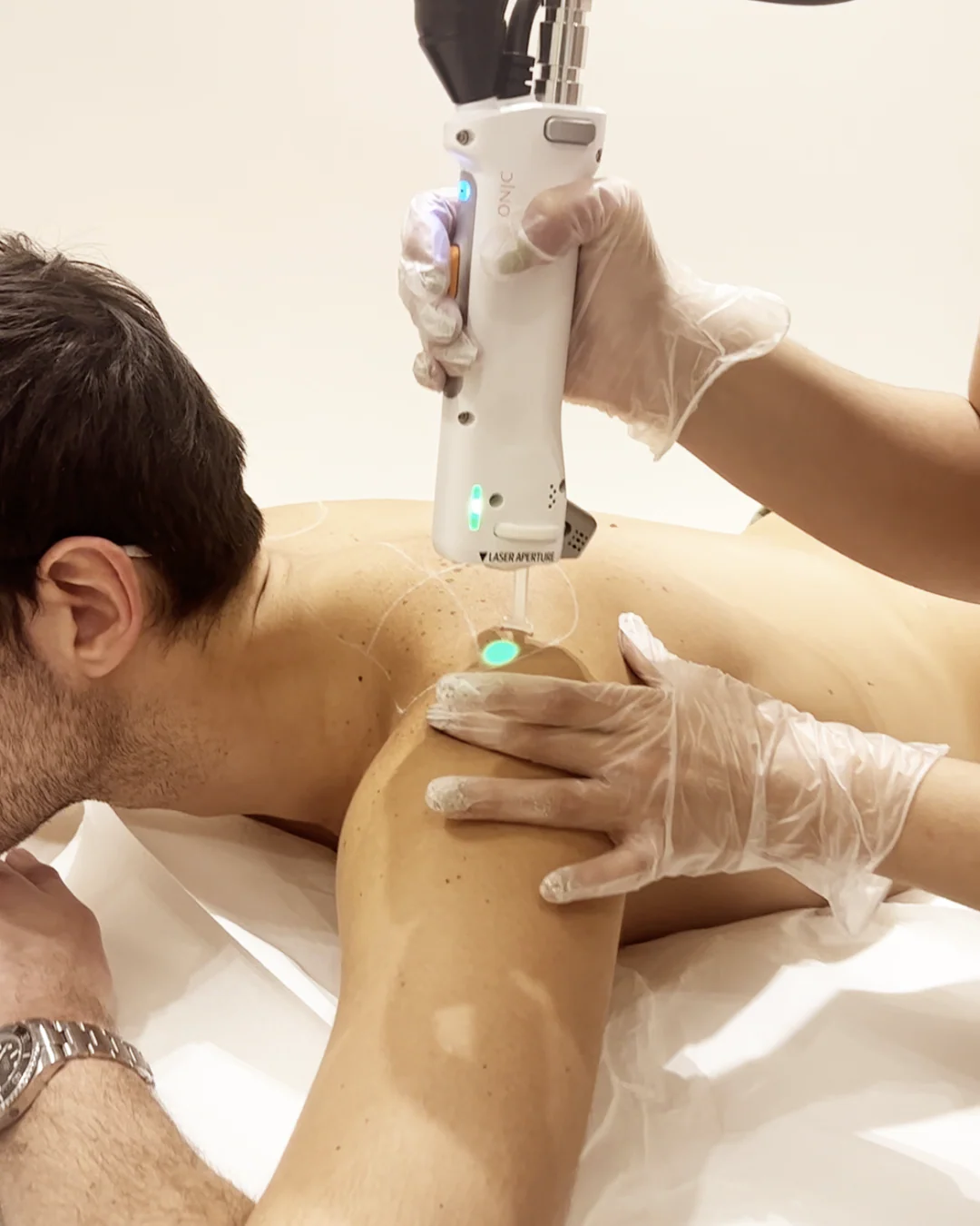Pack De 6 Séances Epilation Laser Epaules - Homme - Image 3