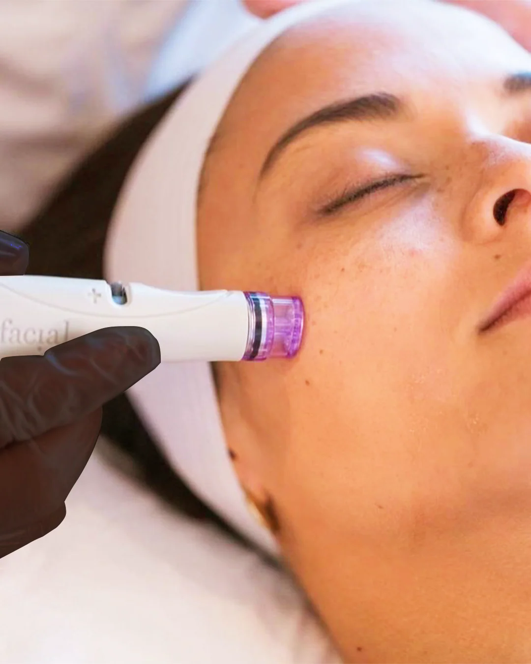 Pack De 3 Séances Hydrafacial Signature - Image 3