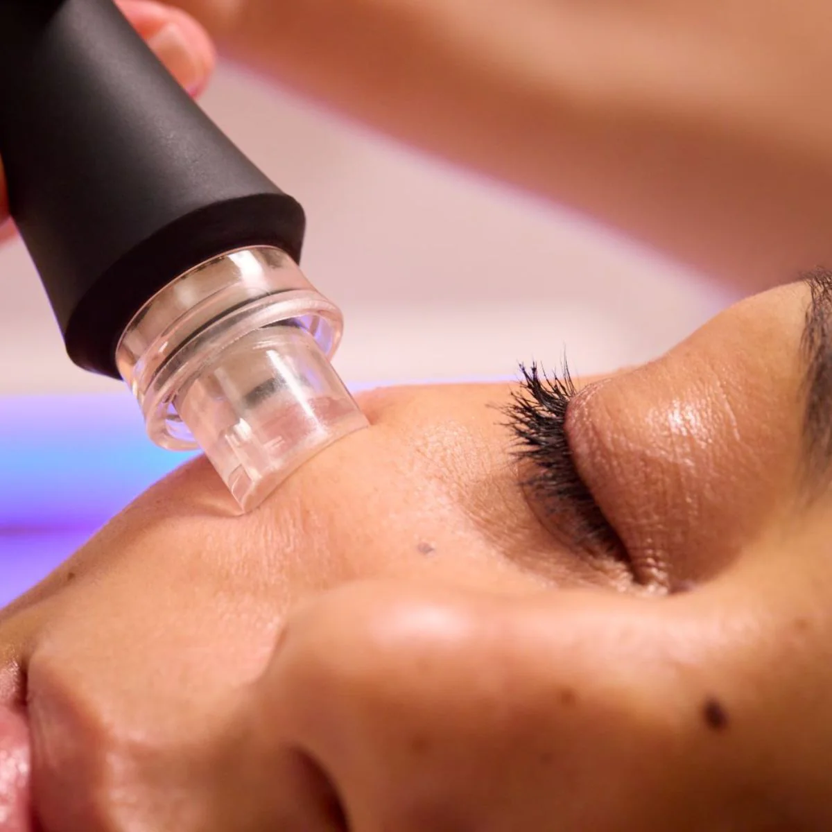 Aquafacial Visage + Diagnostic De Peau - 30 Min - 1 Séance - Image 6